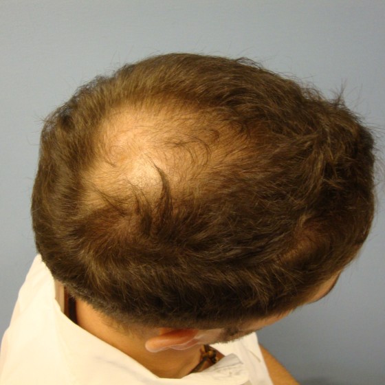 Before