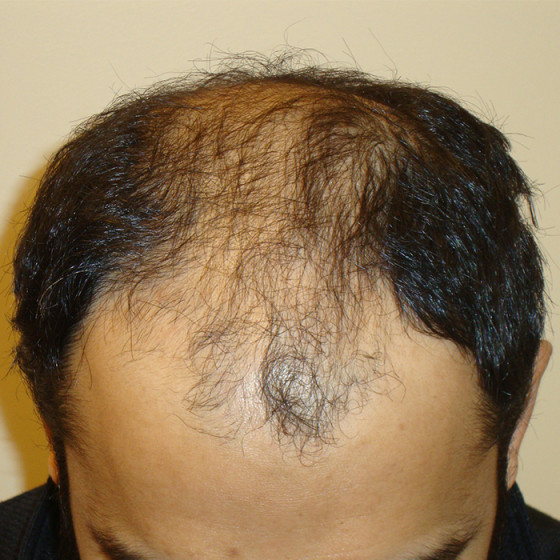 Before