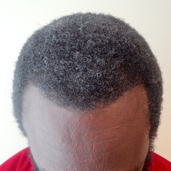 After