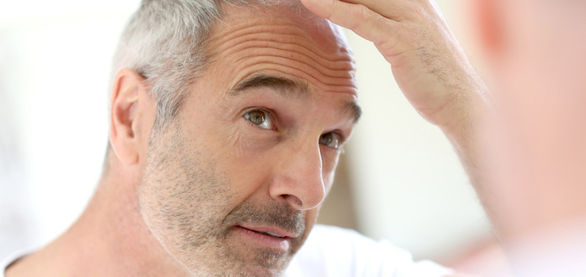 What Causes Hair Loss in Men?