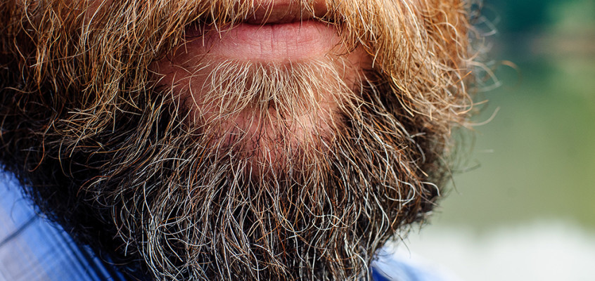 What You Need to Know About A Beard Transplant